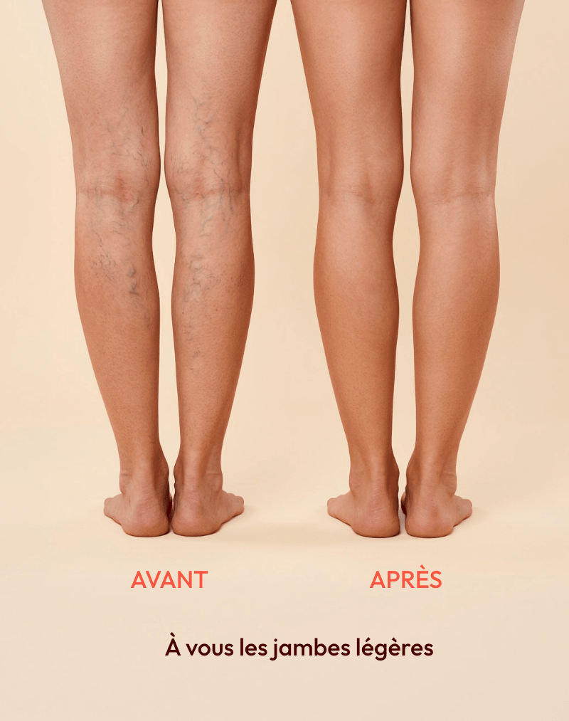 Chaussettes de contention